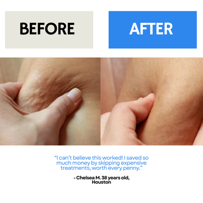 Lymphatic Brush by Pek